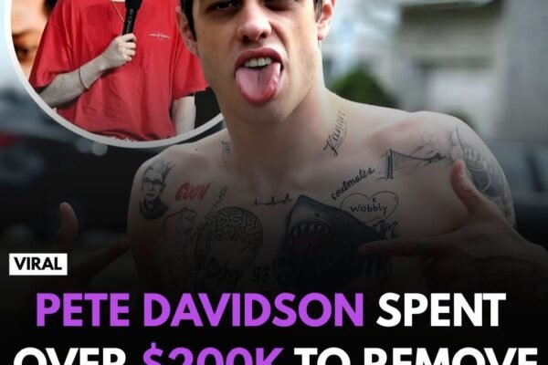Pete Davidson’s $200,000 Tattoo Removal Journey: Why the Comedian Wanted a Fresh Start