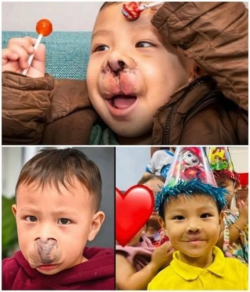 FOR SENG LY, A LIFE-CHANGING SURGERY MEANT MORE THAN A NEW SMILE — IT MEANT BEING ABLE TO PLAY LIKE OTHER CHILDREN